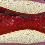 Obat Alami Kolesterol